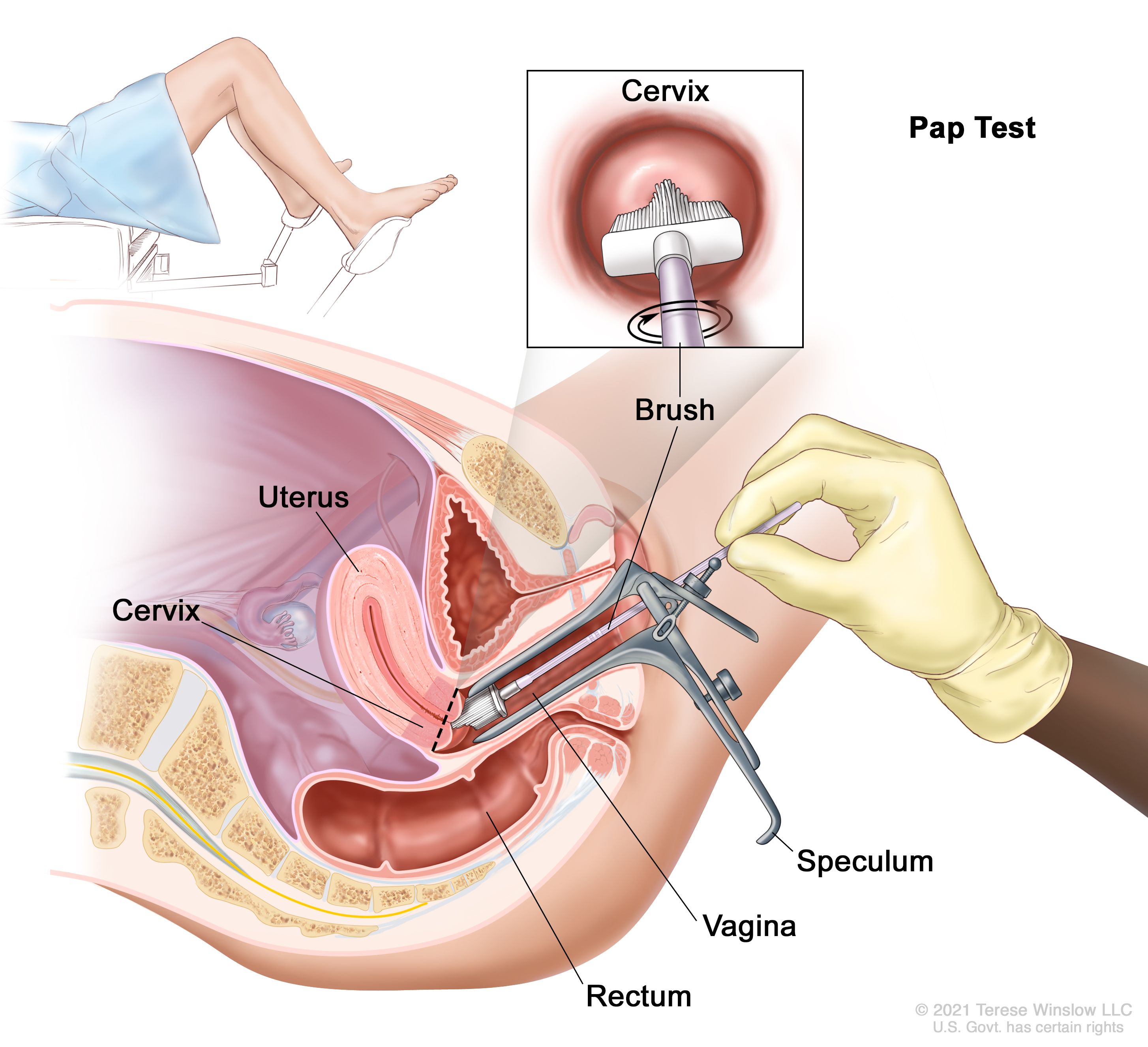 Pap Test